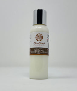 Mela Miracle Eczema and Psoriasis Lotion treats acne, psoriasis, eczema and other skin problems
